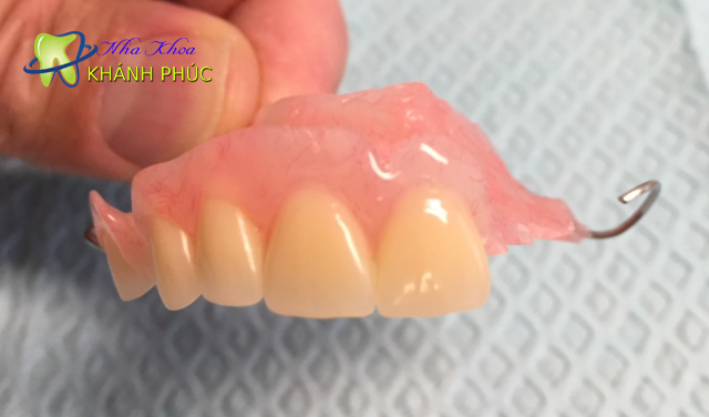 Răng giả tháo lắp mau lỏng sút không bền bằng cầu răng sứ trên Implant