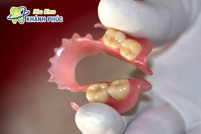 Răng giả tháo lắp nhựa dẻo có tốt không?