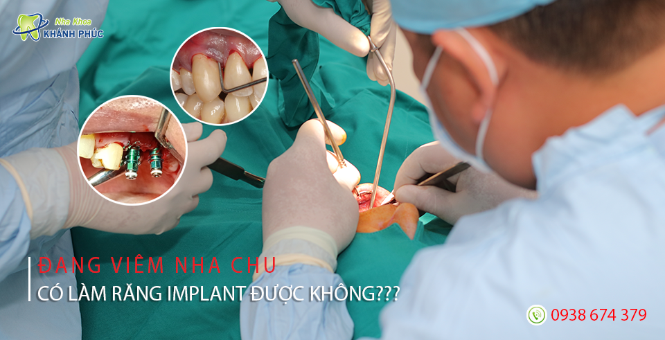 Khi đang viêm nha chu có làm răng Implant được không?