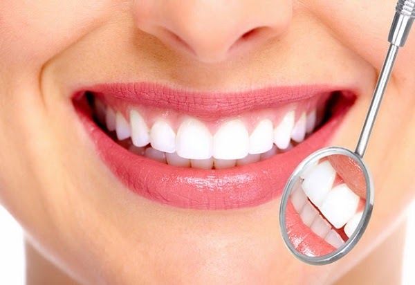 Răng trắng sáng và đẹp tự nhiên sau khi dán sứ veneer