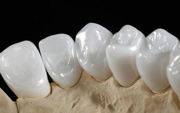 Kỹ thuật bọc răng sứ được nhiều người lựa chọn hiện nay