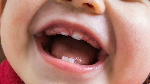 Răng sữa ở trẻ đóng vai trò vô cùng quan trọng