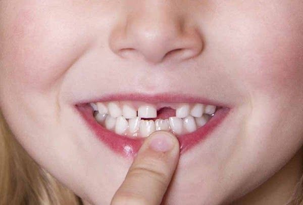 Nên chăm sóc răng sữa cho trẻ tại nha khoa Khánh Phúc