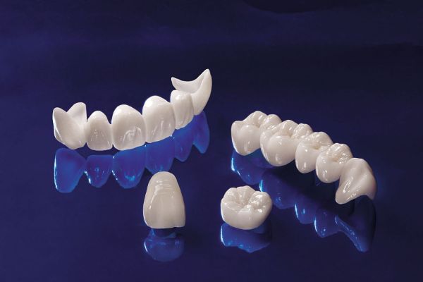 Bị mất răng nên trồng implant