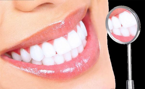 Quy trình tẩy trắng răng gồm nhiều bước