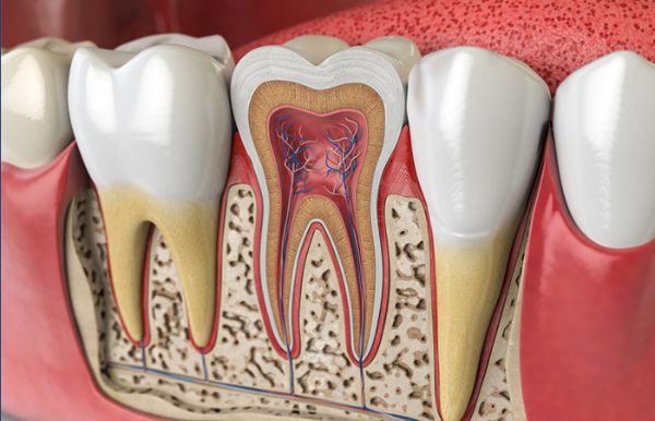 Phương pháp trám răng lấy tủy sở hữu nhiều ưu điểm nổi bật