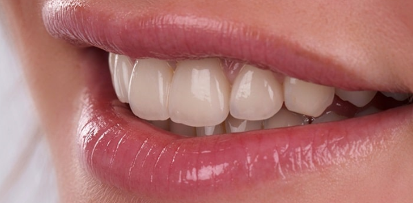 Răng sứ Vita Zirconia