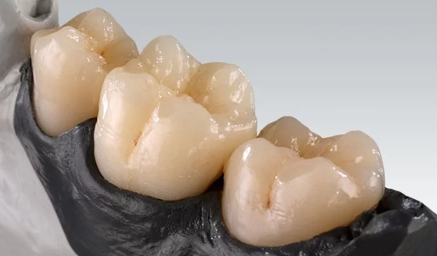 Răng sứ Vita Zirconia có tính thẩm mỹ cao