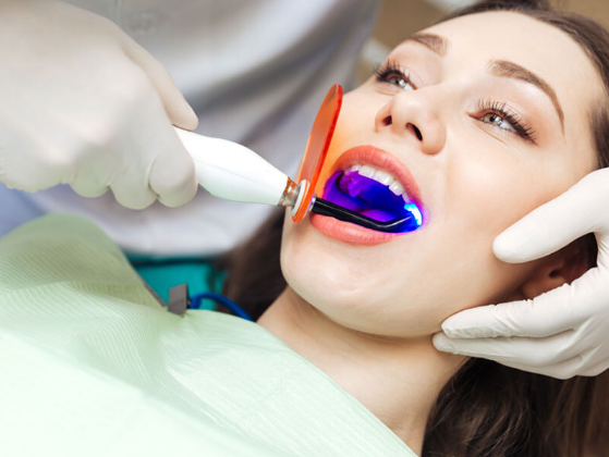 Lựa chọn địa chỉ Nha khoa kém chất lượng dẫn đến tình trạng đau khi tẩy trắng răng