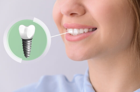 Trồng răng implant ngăn chặn được tình trạng tiêu xương, lão hóa