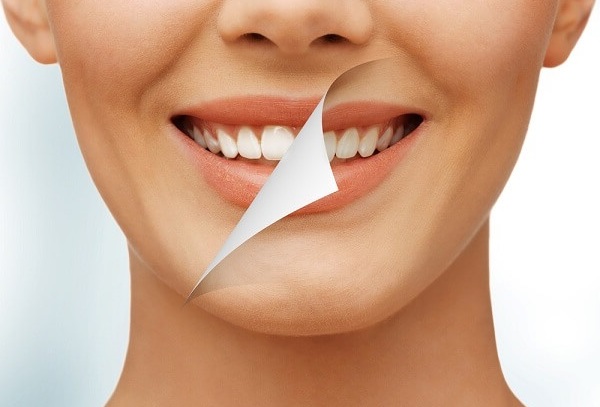 Cách khắc phục răng không đều màu